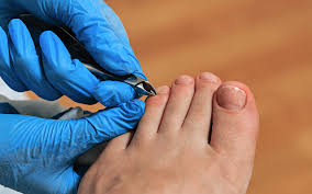 ¿Dolor en la uña del pie?